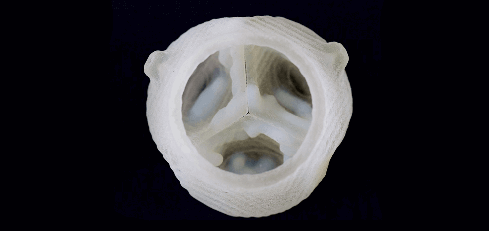 improved-diagnostics-presurgical-planning-high-resolution-functionally-graded-multi-material-3d-printing-biomedical-tomographic-datasets-11 improved-diagnostics-presurgical-planning-high-resolution-functionally-graded-multi-material-3d-printing-biomedical-tomographic-datasets-11